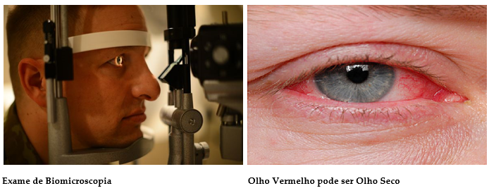 Test ocular săptămânal ciclom)